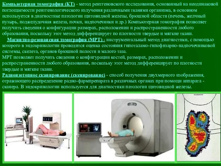 Компьютерная томография (КТ) - метод рентгеновского исследования, основанный на неодинаковой