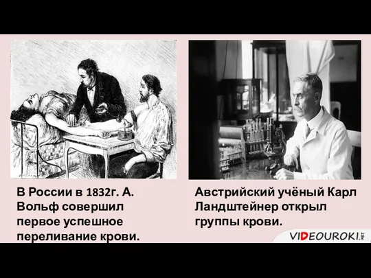 В России в 1832г. А. Вольф совершил первое успешное переливание крови. Австрийский учёный