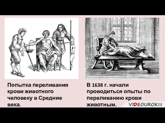 Попытка переливания крови животного человеку в Средние века. В 1638
