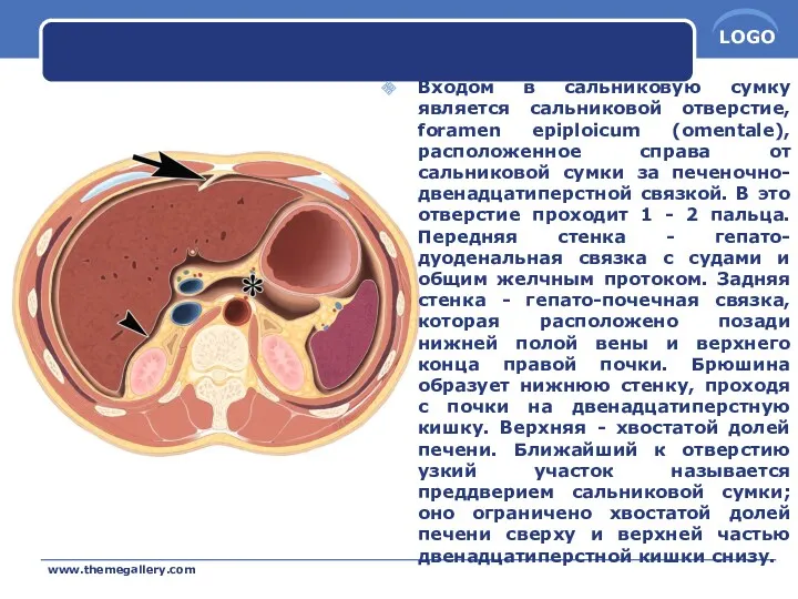 Входом в сальниковую сумку является сальниковой отверстие, foramen epiploicum (omentale),