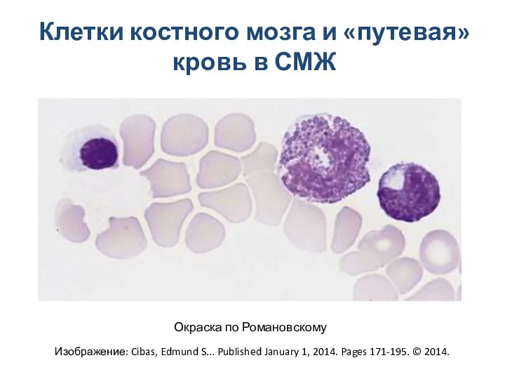 Клетки костного мозга и «путевая» кровь в СМЖ Изображение: Cibas,