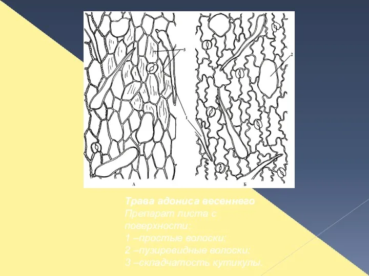 Трава адониса весеннего Препарат листа с поверхности: 1 –простые волоски; 2 –пузиревидные волоски; 3 –складчатость кутикулы.