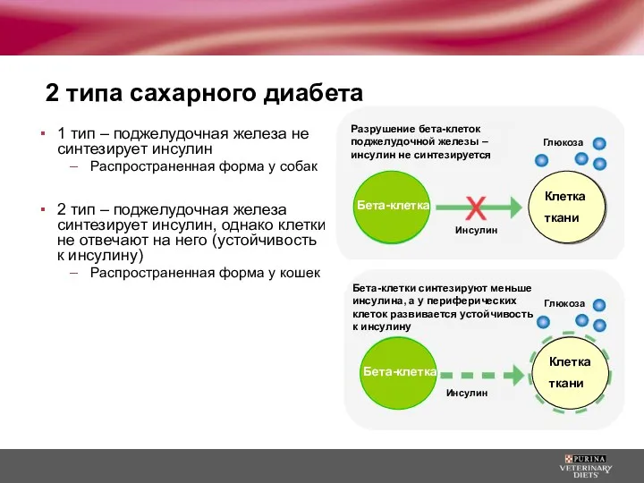 2 типа сахарного диабета 1 тип – поджелудочная железа не