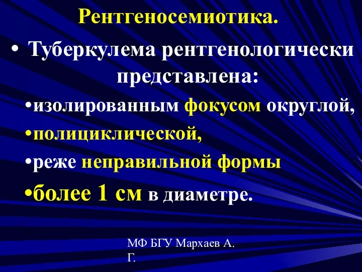 МФ БГУ Мархаев А.Г. Рентгеносемиотика. Туберкулема рентгенологически представлена: изолированным фокусом