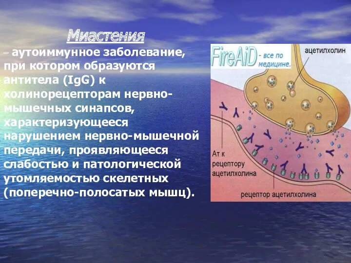 Миастения – аутоиммунное заболевание, при котором образуются антитела (IgG) к