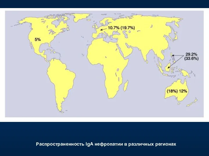 Распространенность IgА нефропатии в различных регионах