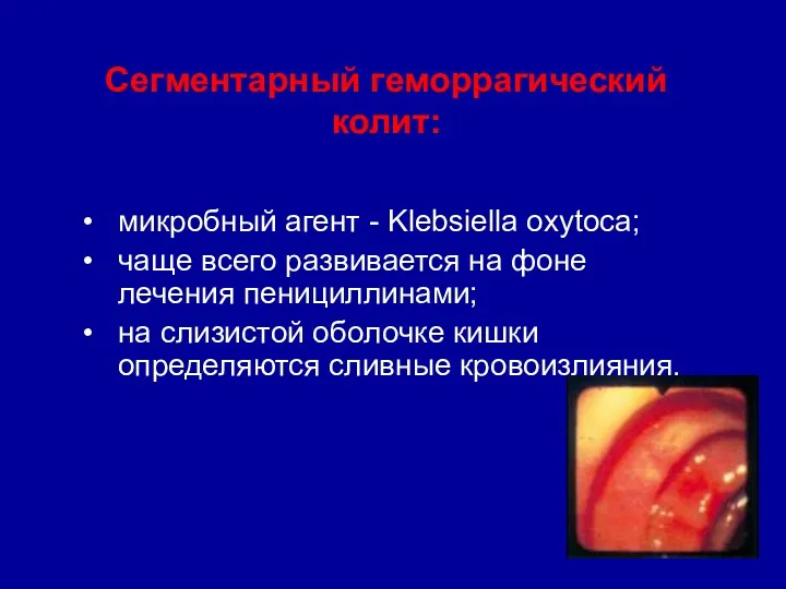 Сегментарный геморрагический колит: микробный агент - Klebsiella oxytoca; чаще всего