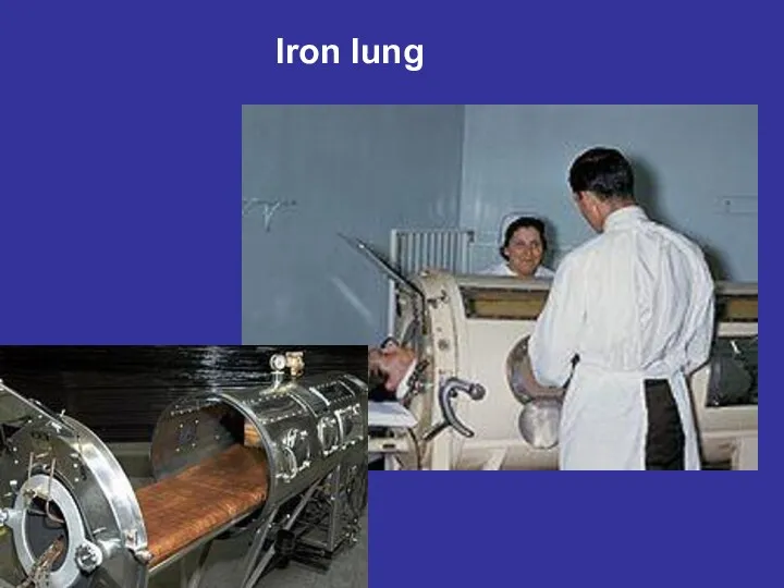 Iron lung