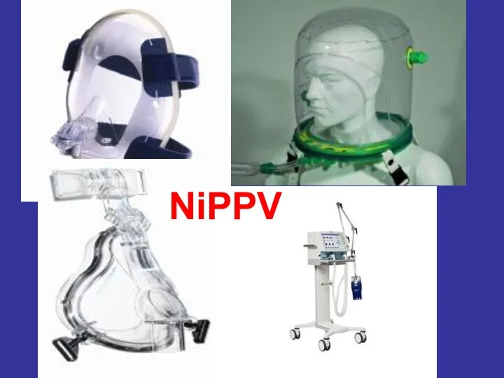 NiPPV