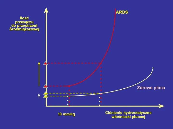 Ciśnienie hydrostatyczne włośniczki płucnej Ilość przesączu do przestrzeni Śródmiąższowej ARDS Zdrowe płuca 10 mmHg