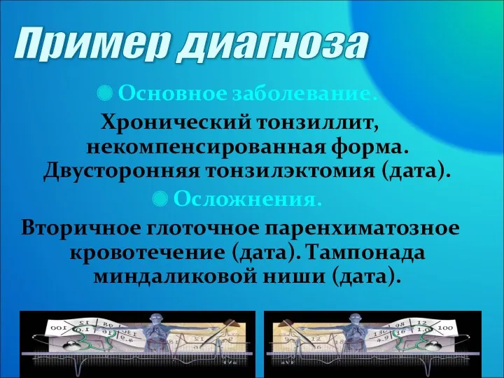 Основное заболевание. Хронический тонзиллит, некомпенсированная форма. Двусторонняя тонзилэктомия (дата). Осложнения.