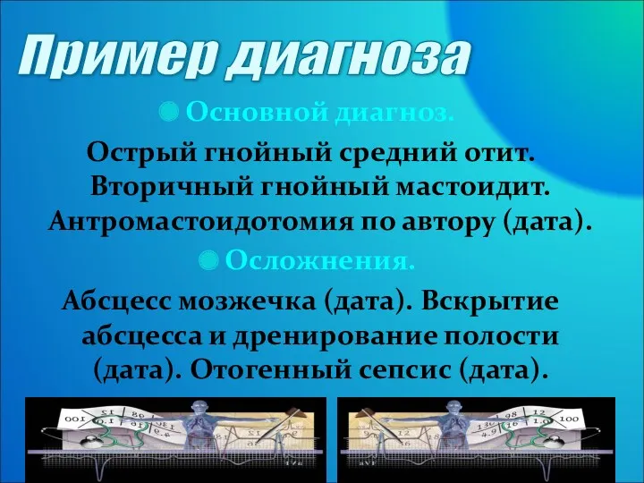 Основной диагноз. Острый гнойный средний отит. Вторичный гнойный мастоидит. Антромастоидотомия