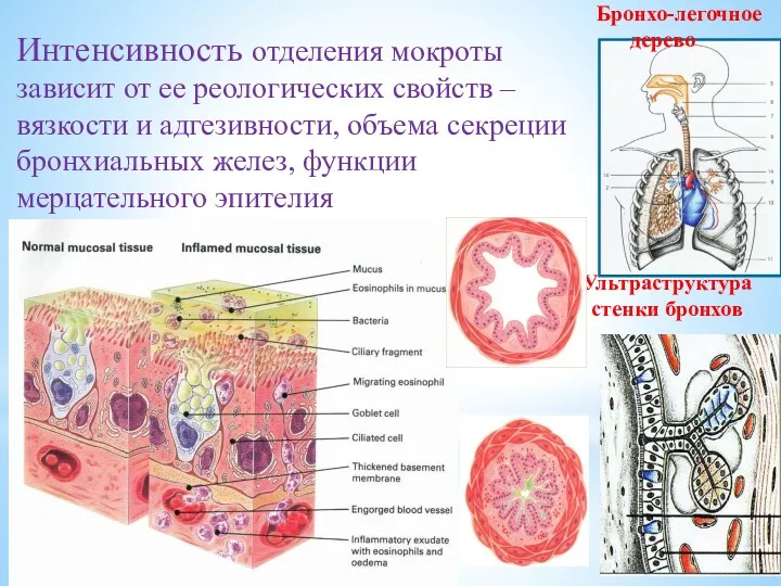 Ультраструктура стенки бронхов Бронхо-легочное дерево Интенсивность отделения мокроты зависит от