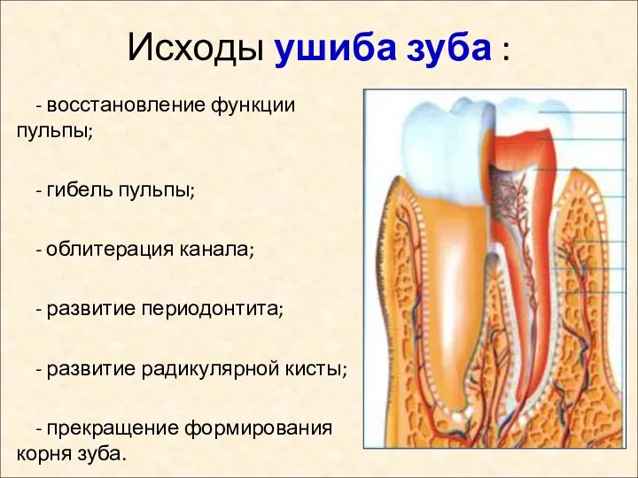 Исходы ушиба зуба : - восстановление функции пульпы; - гибель