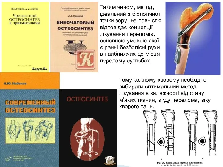 Таким чином, метод, ідеальний з біологічної точки зору, не повністю відповідає концепції лікування