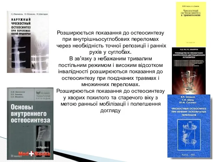 Розширюється показання до остеосинтезу при внутрішньосуглобових переломах через необхідність точної репозиції і ранніх