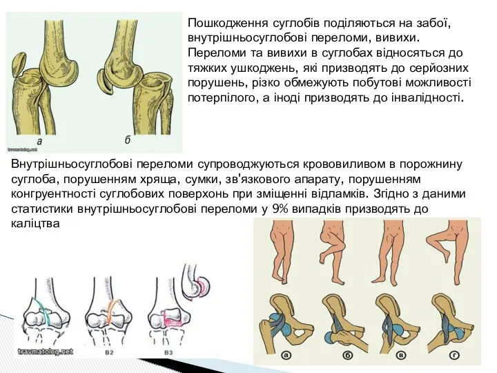 Пошкодження суглобів поділяються на забої, внутрішньосуглобові переломи, вивихи. Переломи та