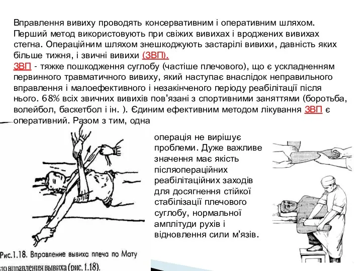 Вправлення вивиху проводять консервативним і оперативним шляхом. Перший метод використовують