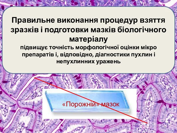 Правильне виконання процедур взяття зразків і подготовки мазків біологічного матеріалу підвищує точність морфологічної