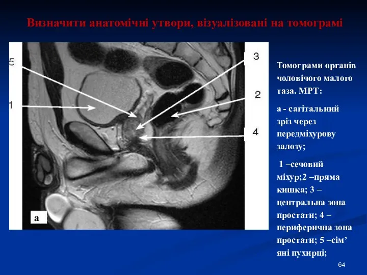 Визначити анатомічні утвори, візуалізовані на томограмі Томограми органів чоловічого малого