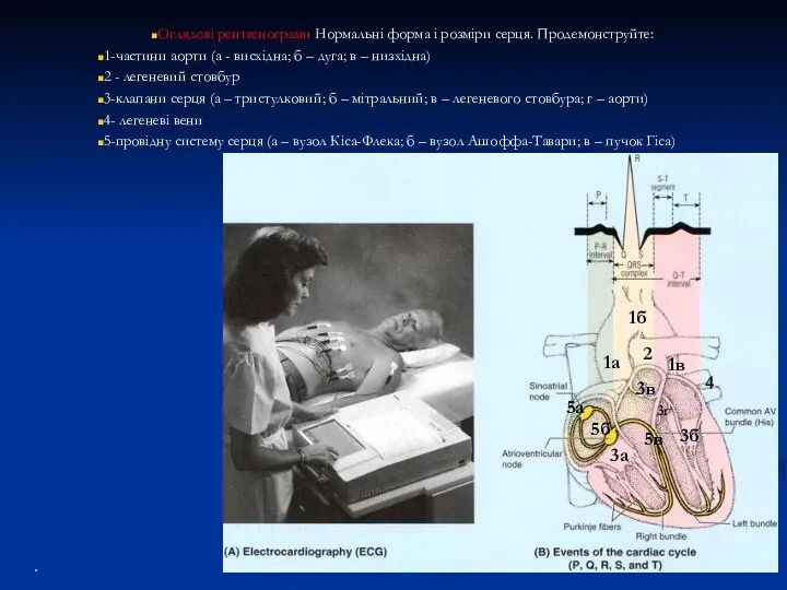 Оглядові рентгенограми Нормальні форма і розміри серця. Продемонструйте: 1-частини аорти