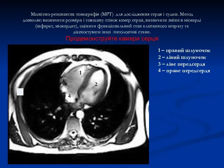 Магнітно-резонансна томографія (МРТ) для дослідження серця і судин. Метод дозволяє: