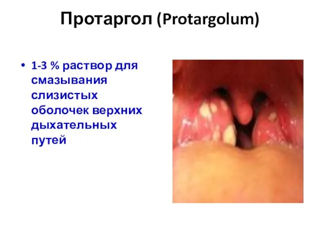 Протаргол (Protargolum) 1-3 % раствор для смазывания слизистых оболочек верхних дыхательных путей