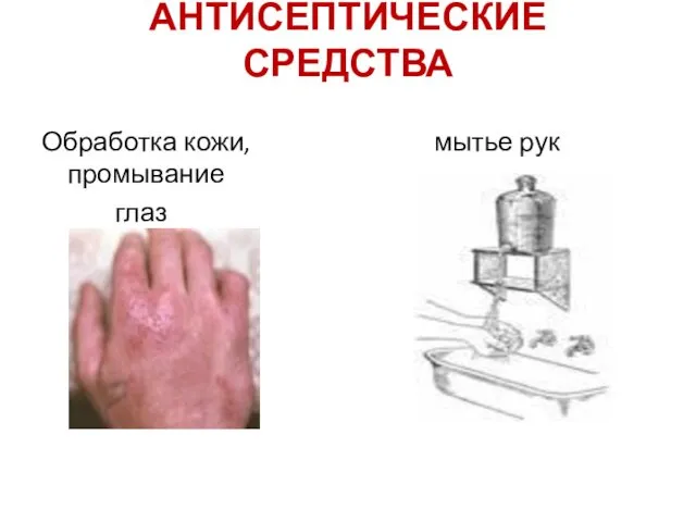 АНТИСЕПТИЧЕСКИЕ СРЕДСТВА Обработка кожи, промывание глаз мытье рук
