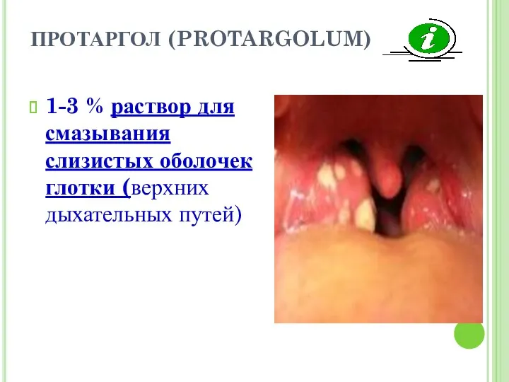 ПРОТАРГОЛ (PROTARGOLUM) 1-3 % раствор для смазывания слизистых оболочек глотки (верхних дыхательных путей)