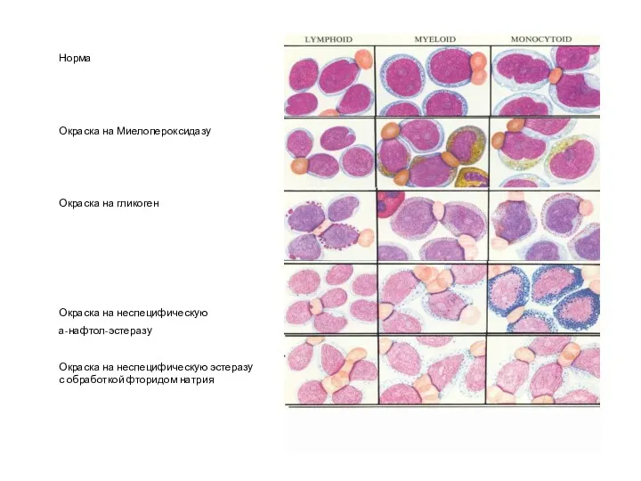 Норма Окраска на Миелопероксидазу Окраска на гликоген Окраска на неспецифическую