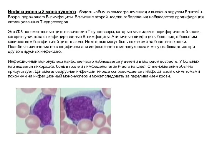 Инфекционный мононуклеоз - болезнь обычно самоограниченная и вызвана вирусом Епштейн-Барра,