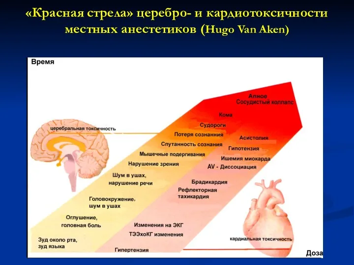 «Красная стрела» церебро- и кардиотоксичности местных анестетиков (Hugo Van Aken)