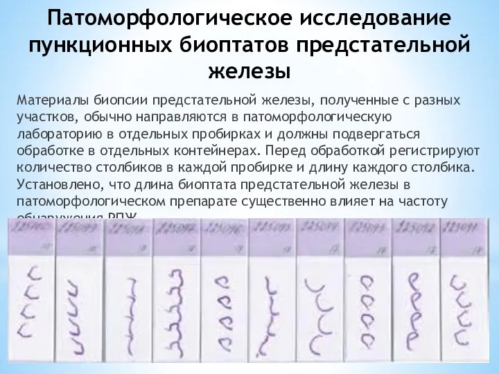 Патоморфологическое исследование пункционных биоптатов предстательной железы Материалы биопсии предстательной железы,