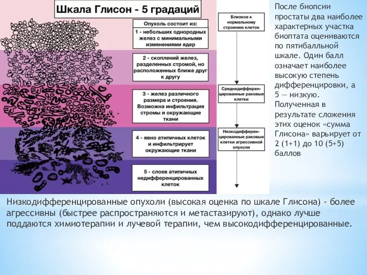 После биопсии простаты два наиболее характерных участка биоптата оцениваются по пятибалльной шкале. Один