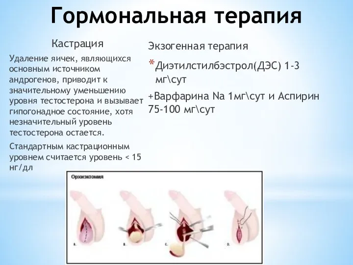 Гормональная терапия Кастрация Удаление яичек, являющихся основным источником андрогенов, приводит к значительному уменьшению