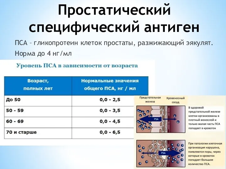 Простатический специфический антиген ПСА – гликопротеин клеток простаты, разжижающий эякулят. Норма до 4 нг/мл