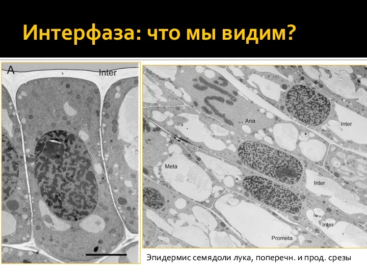 Интерфаза: что мы видим? Эпидермис семядоли лука, поперечн. и прод. срезы