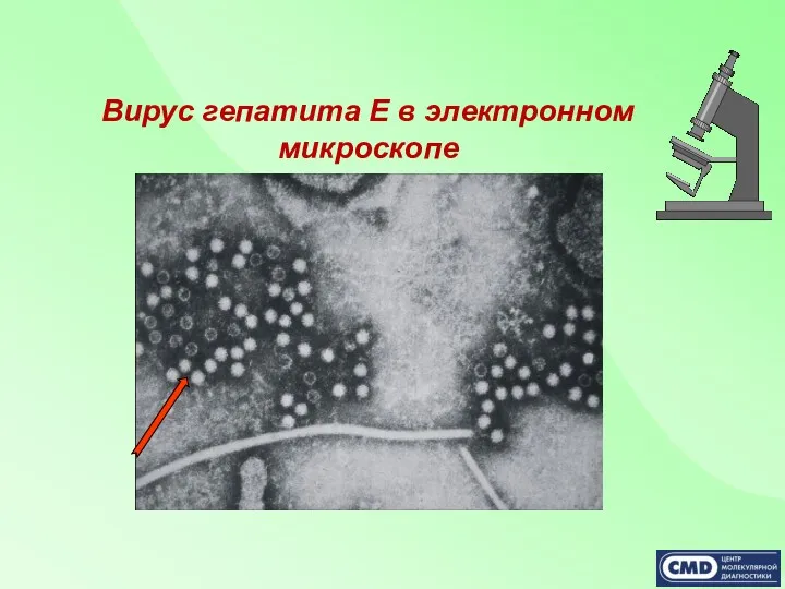 Вирус гепатита Е в электронном микроскопе