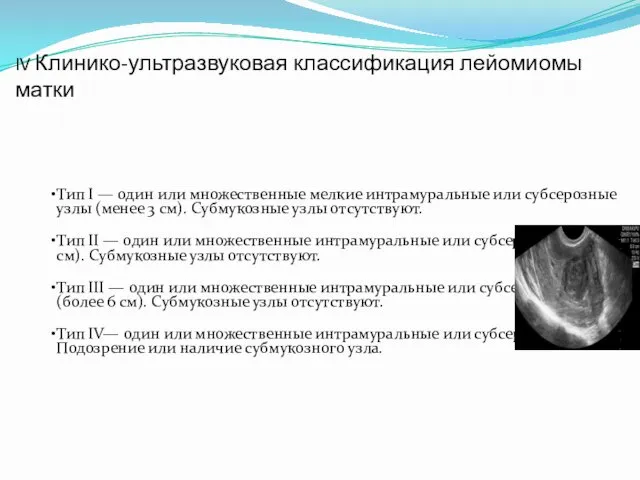 IV Клинико-ультразвуковая классификация лейомиомы матки Тип I — один или