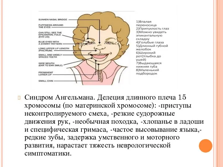 Синдром Ангельмана. Делеция длинного плеча 15 хромосомы (по материнской хромосоме):