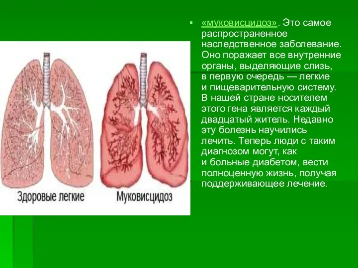 «муковисцидоз». Это самое распространенное наследственное заболевание. Оно поражает все внутренние