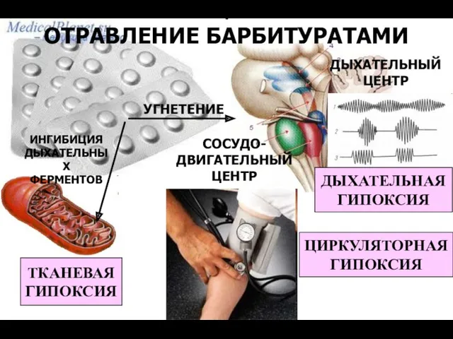 ТКАНЕВАЯ ГИПОКСИЯ ИНГИБИЦИЯ ДЫХАТЕЛЬНЫХ ФЕРМЕНТОВ ОТРАВЛЕНИЕ БАРБИТУРАТАМИ УГНЕТЕНИЕ ДЫХАТЕЛЬНЫЙ ЦЕНТР