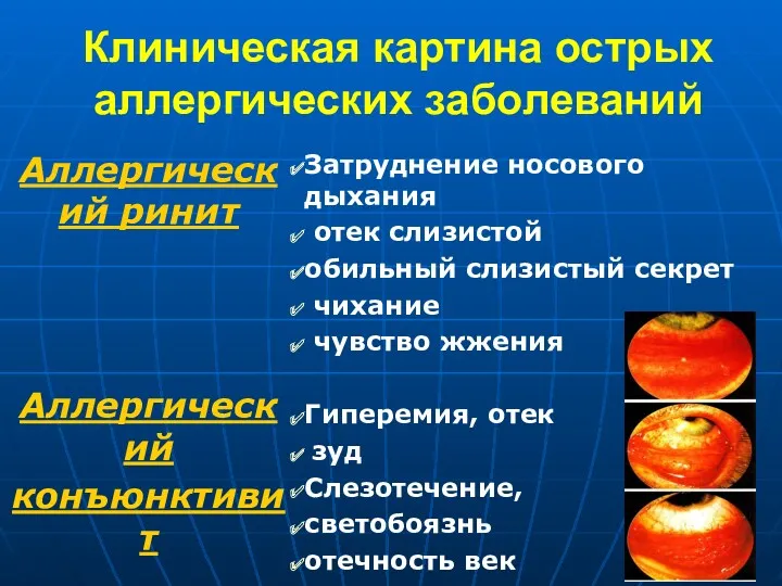 Клиническая картина острых аллергических заболеваний