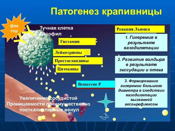 Гистамин Тучная клетка Базофил 1. Гиперемия в результате вазодилятации Увеличение