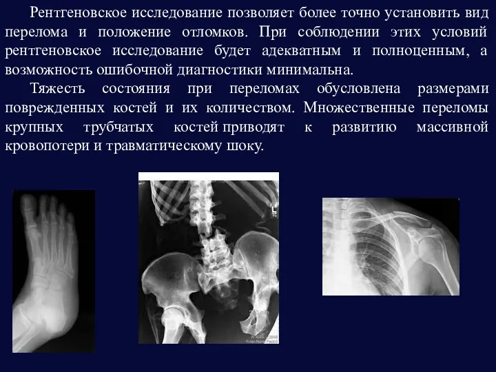 Рентгеновское исследование позволяет более точно установить вид перелома и положение