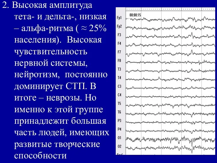 2. Высокая амплитуда тета- и дельта-, низкая – альфа-ритма ( ≈ 25% населения).