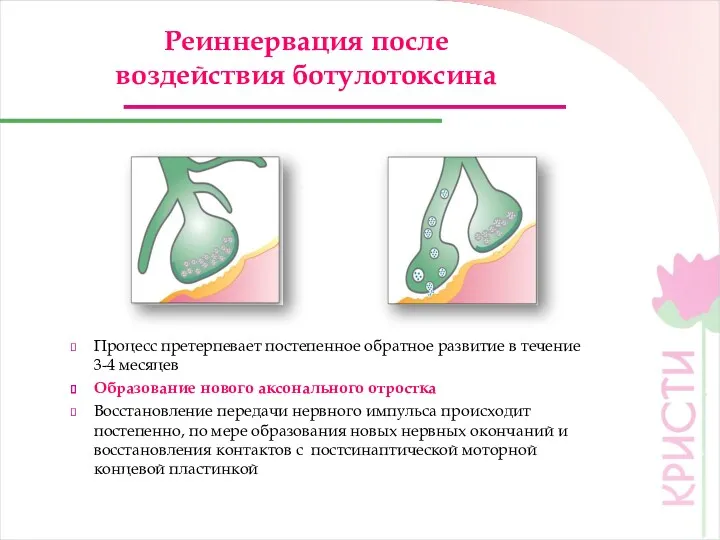 Реиннервация после воздействия ботулотоксина Процесс претерпевает постепенное обратное развитие в