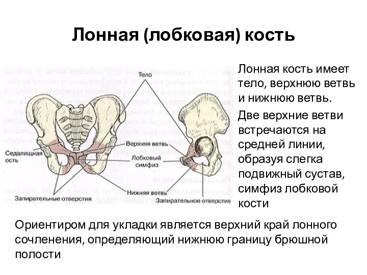 Лонная (лобковая) кость Лонная кость имеет тело, верхнюю ветвь и