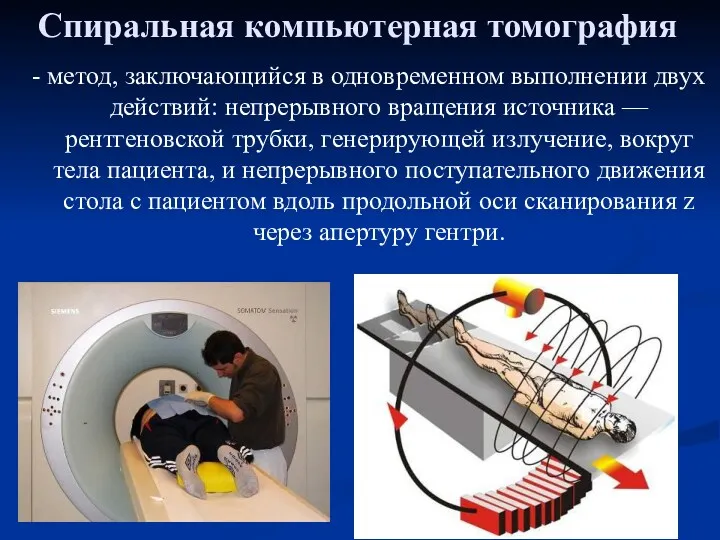 Спиральная компьютерная томография - метод, заключающийся в одновременном выполнении двух