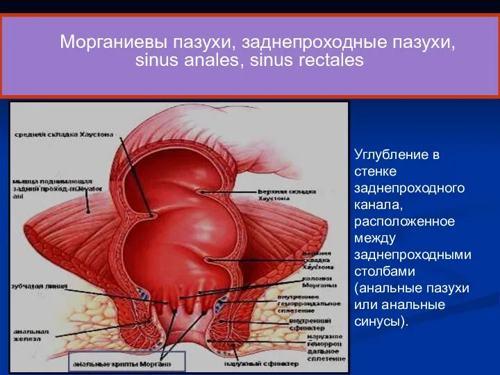 Морганиевы пазухи, заднепроходные пазухи, sinus anales, sinus rectales Углубление в